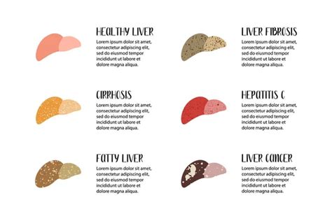 Hígado sano y diversas enfermedades hepáticas Hepatología Etapas de