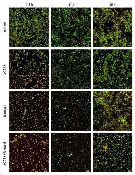 Confocal Laser Scanning Micrographs Of Treated And Untreated Silicone