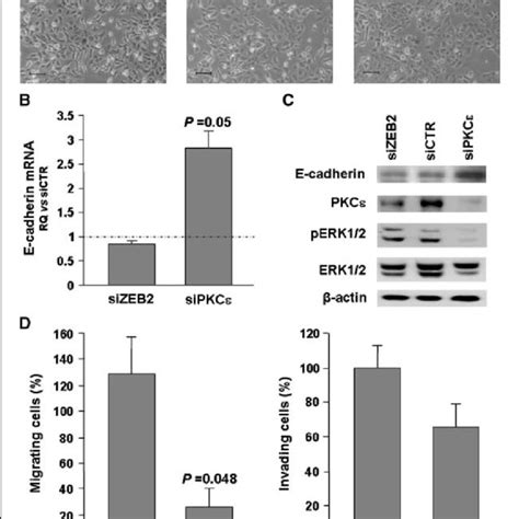 Knockdown Of PKCq Rather Than ZEB2 Phenocopies MiR 205 Ectopic