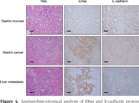 Figure 4 From Tumorigenesis And Neoplastic Progression Role Of Es Cell