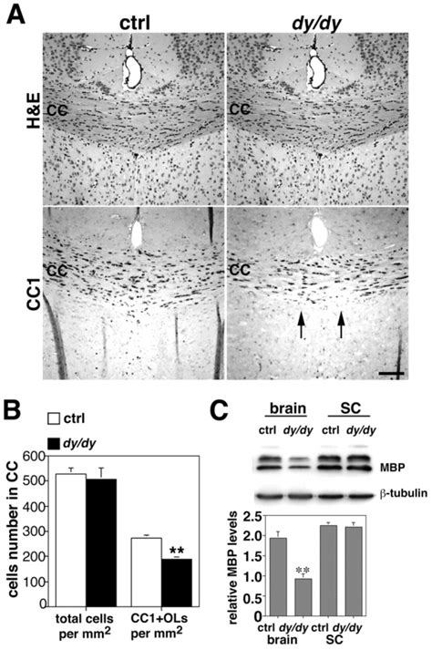 Dy Dy Mice Are Myelin Deficient And Have Fewer Mature Oligodendrocytes