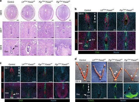 Uterine Glands Are Essential For Decidual Progression And Pregnancy