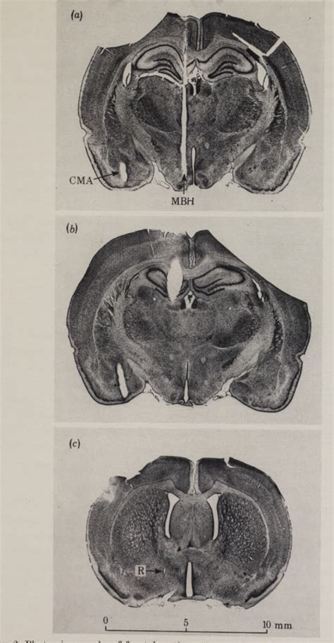 Figure 2 From Electrophysiological Evidence For Sexual Dimorphism And