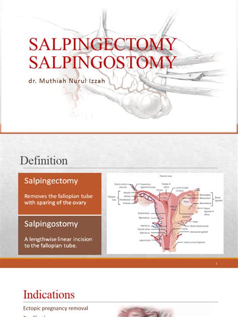 salpingectomy salpingotomy proceduer  diseases  disorders