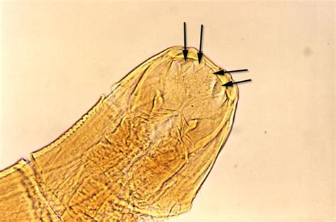 Ancylostoma Braziliense Morphology