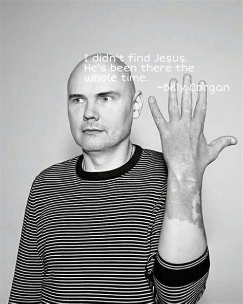Billy Corgan Hand Birthmark