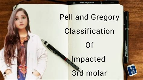 pell  gregory classification  impacted  molar youtube