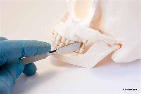 Maxillofacial Surgery - Common Medical Tourism Procedures - Medical ...