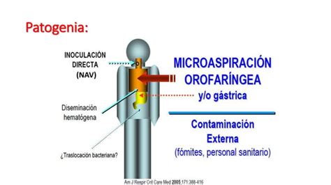 Neumon A Intrahospitalaria En El Adulto Mayor Ppt