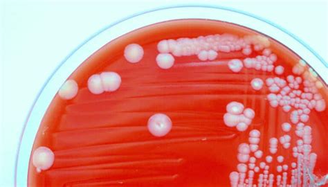 Enterotoxigenic E. coli (ETEC) - Futurity