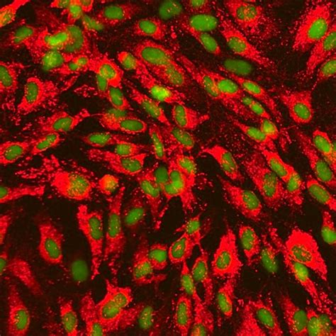 Human Pancreatic Microvascular Endothelial Cells Innoprot Cell Systems