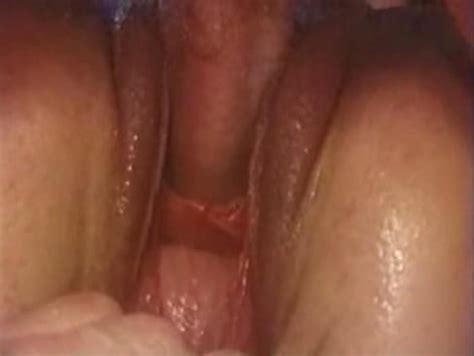 Female Pee Hole Sounding Sex