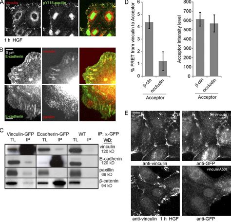 Vinculin Closely Interacts With The E Cadherin Complex A Recruitment