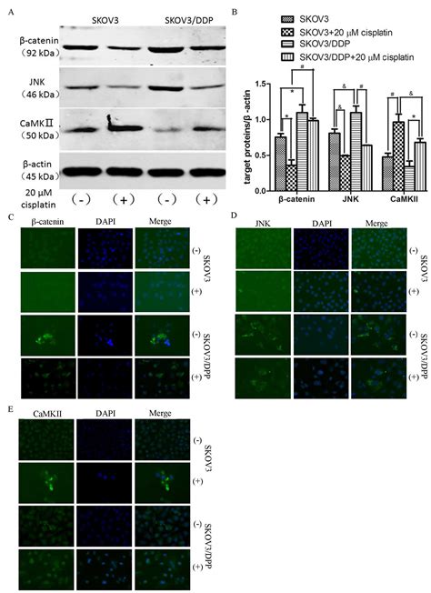 Role of Wnt βcatenin Wnt cJun Nterminal kinase and Wnt Ca2