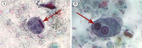 Entamoeba Histolytica Cyst