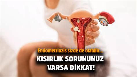 Endometriozis Nedir Belirtileri Nelerdir Nas L Tedavi Edilir