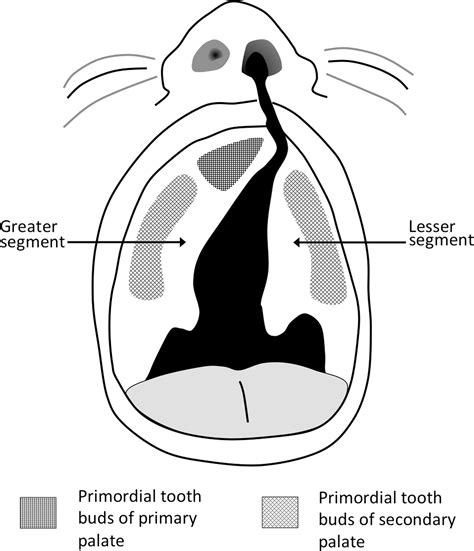 Radiology Of Cleft Lip And Palate Imaging For The Prenatal Period And