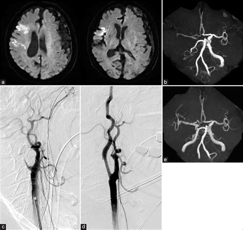 Surgical Neurology International