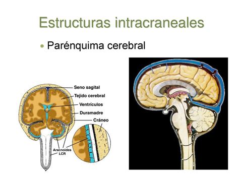 Urgencias Neurológicas Ppt Descargar