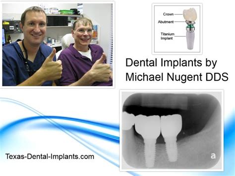 Michael Nugent Dds 3421 Burke Rd Pasadena Texas 77504 Dental