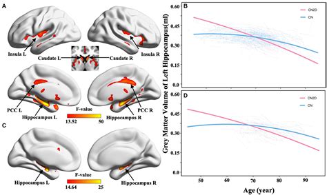 Frontiers Apolipoprotein E ε4 accelerates the longitudinal cerebral