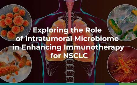 Exploring The Role Of Intratumoral Microbiome In Enhancing