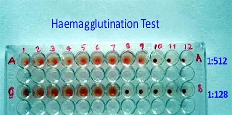 Hemagglutination Assay Its Principle Procedure And Interpretation