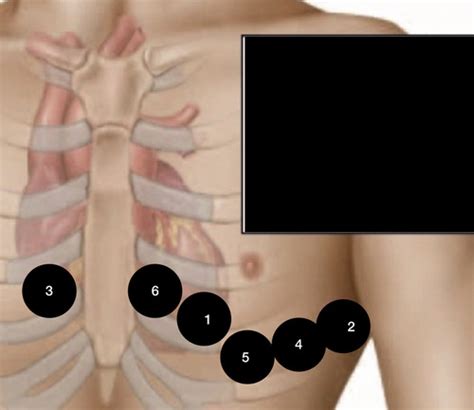 Ecg Procedure Flashcards Quizlet