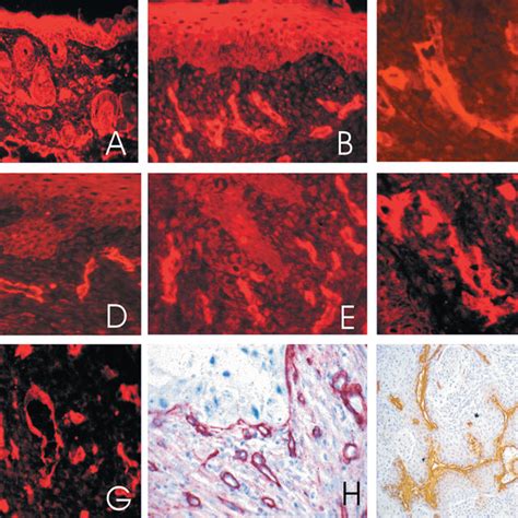 Dmba Induced Lesions And Tumors In Mouse Skin A Epidermal Dysplasia