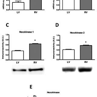 Real-Time RT-PCR and Western blot analysis of HK1 (A, C) and HK2 (B, D ... 