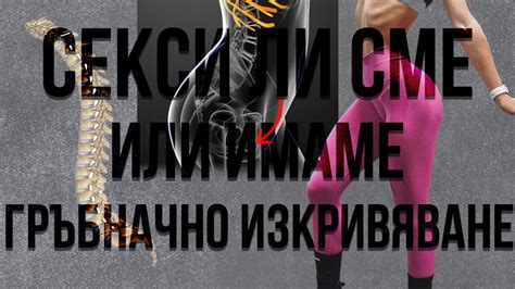 Секси ли сме или имаме гръбначно изкривяване? - YouTube