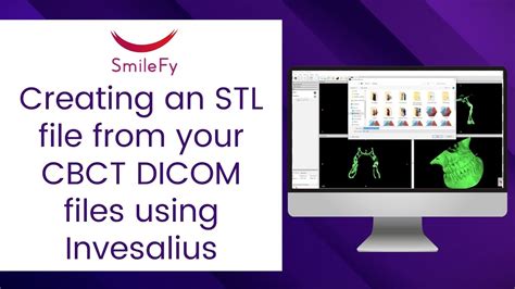 Tutorial Creating An Stl File From Your Cbct Dicom Files Using