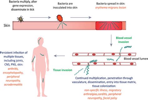 Progression of Lyme disease in humans following B. burgdorferi... | Download Scientific Diagram