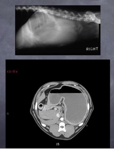 Dim 400 Abdomen Git Radiography Flashcards Quizlet