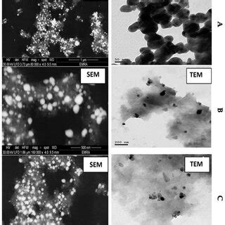 Transmission Electron Microscopy (TEM) and Scanning Electron Microscopy ... 