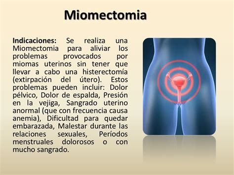 Miomectomia Diapo