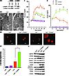 JCI Ablation of C EBPβ alleviates ER stress and pancreatic β cell