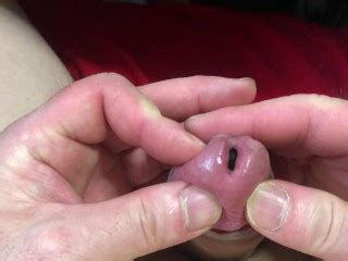 ぷよぷよボールでペニスのリハビリをしています 3 5 6 Pornhub Gay