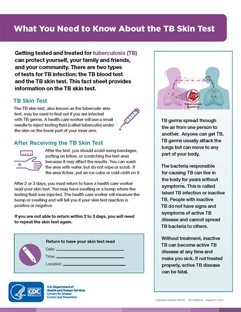 Mantoux Tuberculin Skin Test Toolkit Tuberculosis Tb Cdc