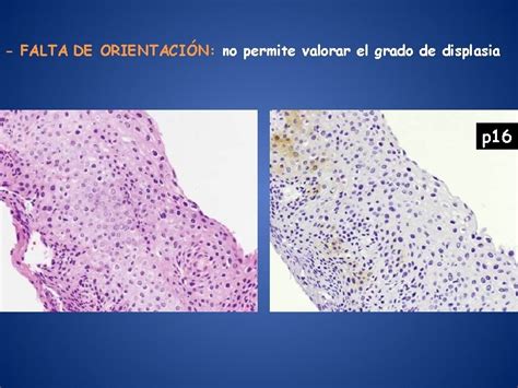 Protocolos De Seguimiento Y Tratamiento De Las Lesiones