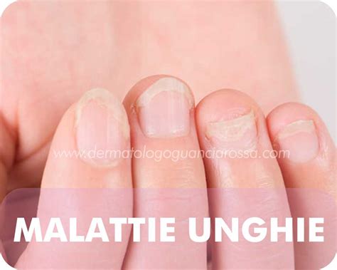 Dermatologo Malattie Unghie A Sant Ippolito E Fossombrone Dott Ssa