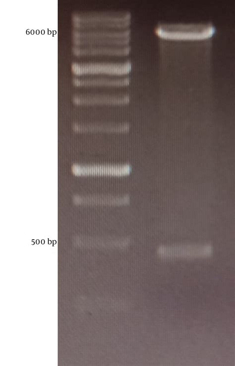 Confirmation Digestion PET26b Plasmid Containing MPD 1 Extracellular