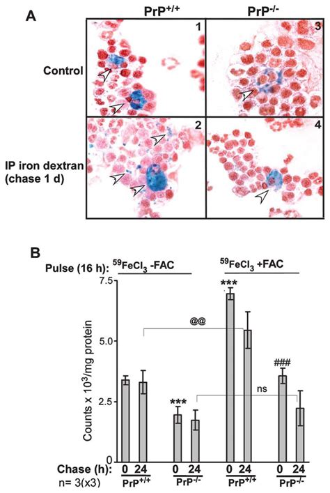 Bone Marrow B Macrophages Of Prp Mice Show Impaired Iron Uptake