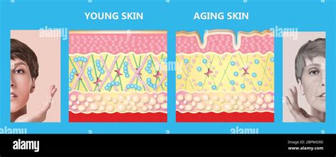 Los jóvenes y el envejecimiento de la piel La piel de elastina y