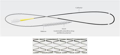 Resolute Onyx Zotarolimus Eluting Coronary Stent System Onyx Frontier