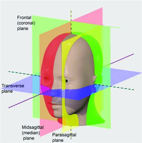 Representation of midsagittal and parasagittal planes. Reproduced from ...