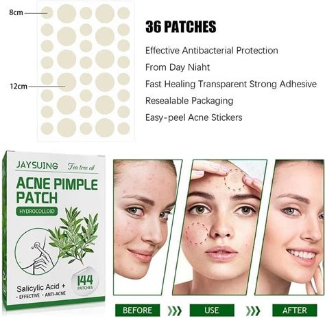 Buy 144pcsbox Invisible Acne Removal Pimple Patch Beauty Acne Tools