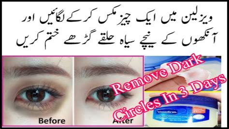 Vaseline To Remove Dark Circles And Fine Lines Under Eyes Youtube