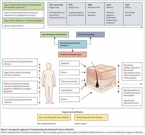 MedClub On Twitter RT CarlosJMoreno Review ID TheLancetInfDis