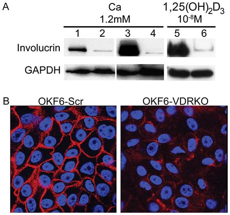 Vitamin D Signaling Regulates Oral Keratinocyte Proliferation In Vitro